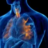 Aumentan los casos de bronquiolitis y neumonía por la circulación del Virus Sincicial Respiratorio