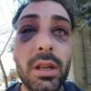 Un luthier denunció una brutal golpiza policial en Santa Rosa: “No me mataron porque tuve suerte”