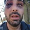 Un luthier denunció una brutal golpiza policial en Santa Rosa: “No me mataron porque tuve suerte”