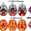 El cerebro bajo efectos psicodélicos no es tan caótico como se creía